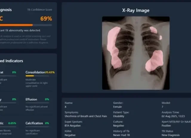 UGM Kembangkan Aplikasi Skrining TBC Berbasis AI Pertama di Indonesia